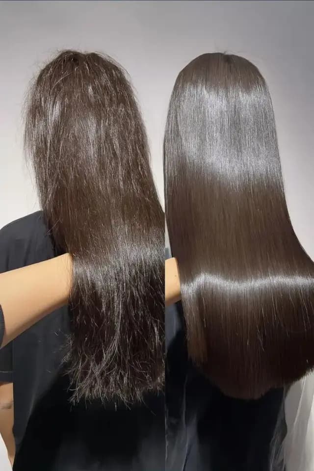 Ozone Therapy for Hair