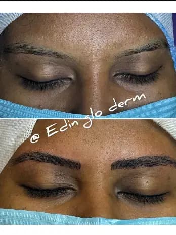 Eyebrow Microblading